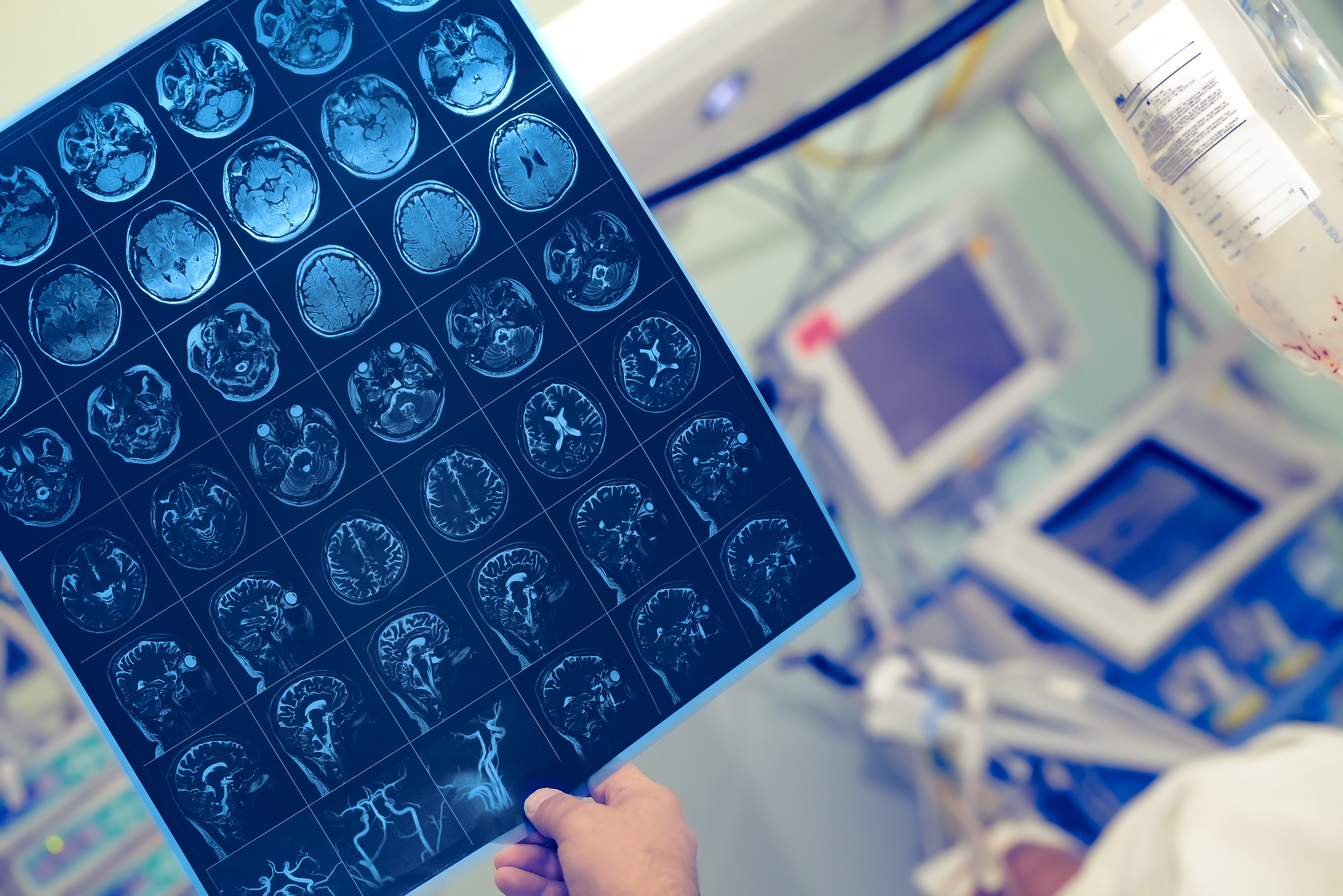 Healthcare professional reviewing multiple brain scan images on a monitor while supporting advanced stroke care assessment in a clinical setting